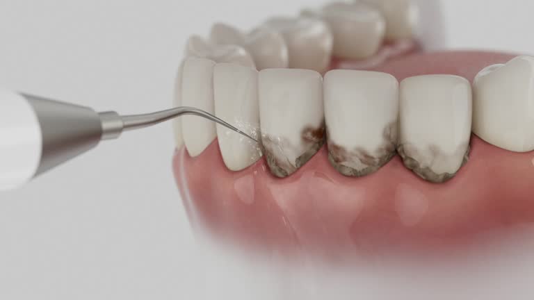 Trusted Root Canal Treatment service in Aquia Harbour, VA - Dentist Open Now